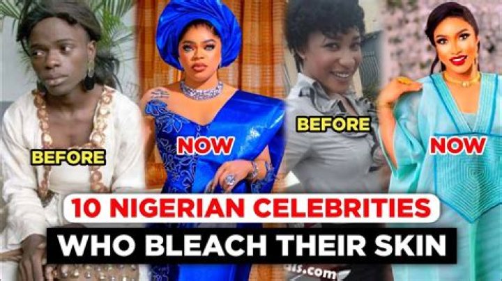 10 Celebrities Who Bleached Their Skin (Before and After Photos) Tuko.co.ke