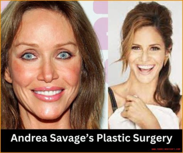 A Deep Dive Into Her Plastic Surgery Journey