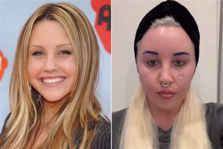 Amanda Bynes will remain on psychiatric hold as she is still under