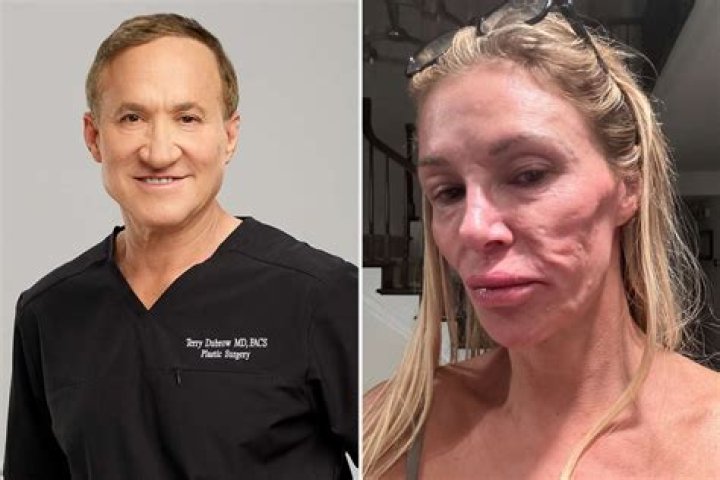 Dr. Terry Dubrow reveals the plastic surgery procedure is more popular
