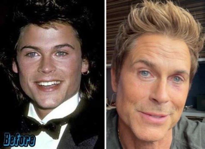 Has Rob Lowe Had a Stroke? Fans Have Questions