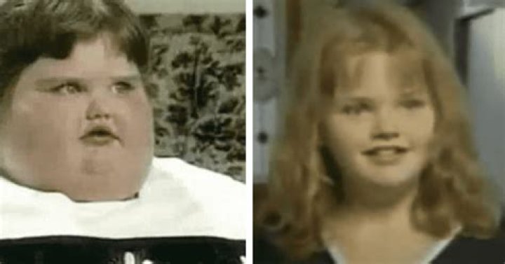 Jessica Gaude World's fattest child loses weight without surgery