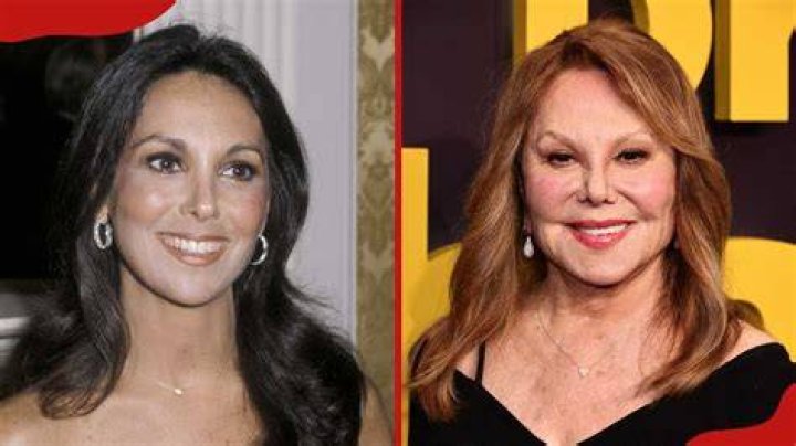 Marlo Thomas Plastic Surgery Before and After Facelift Star Plastic