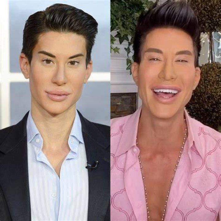 Meet The Real-Life Ken: Justin Jedlica