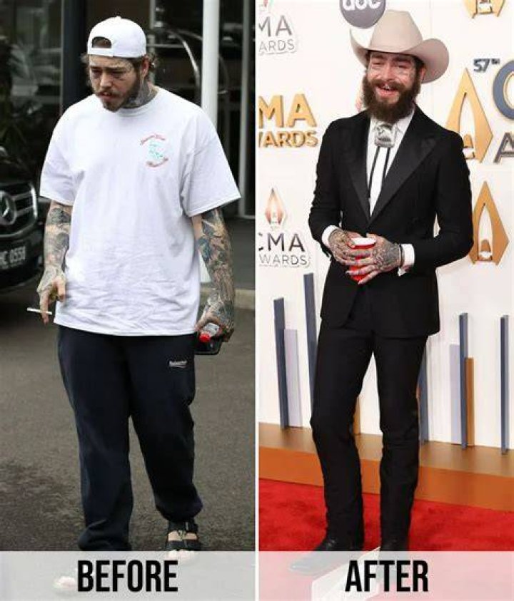 Post Malone Weight Loss Addressed