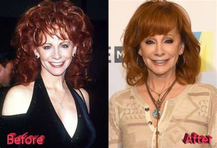 Reba McEntire Plastic Surgery? See Her Transformation