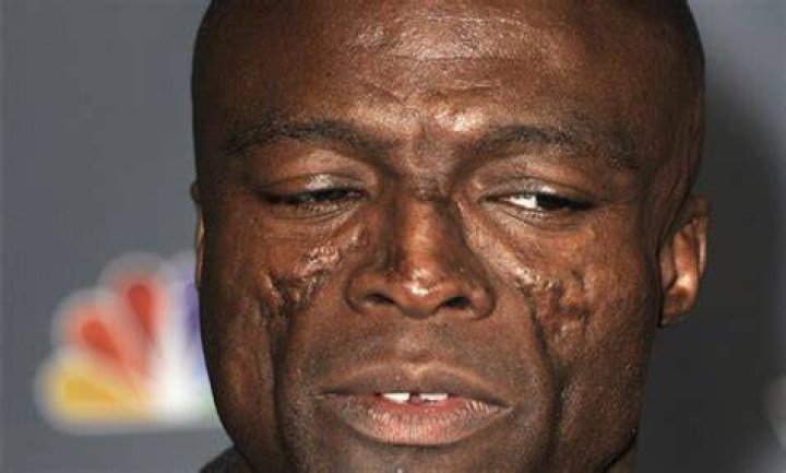 Seal Face Scars
