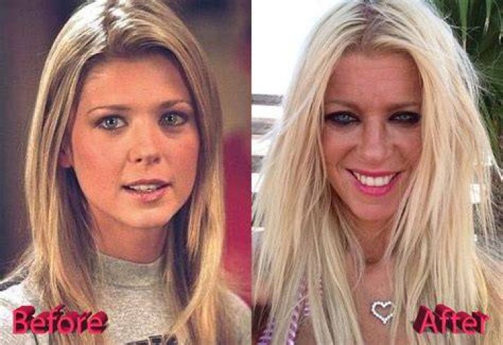 Tara Reid Before And After, Plastic Surgery, Net worth Networth Height Salary